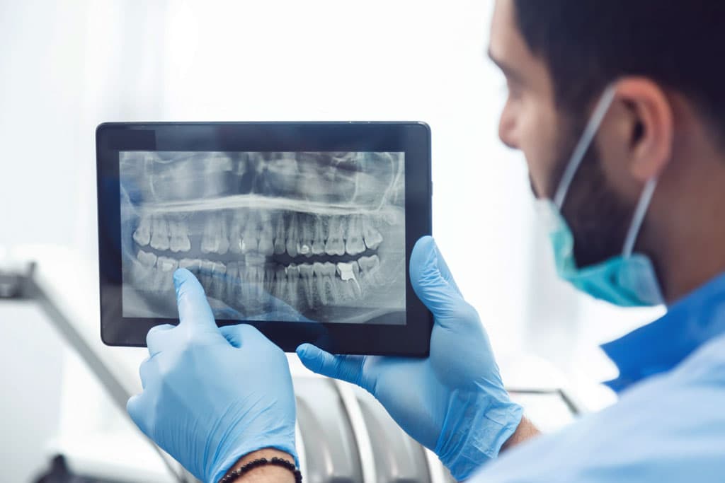 Dudas frecuentes sobre tratamientos dentales